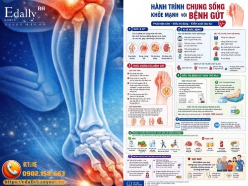 Hành Trình Chung Sống Khỏe Mạnh Với Bệnh Gút