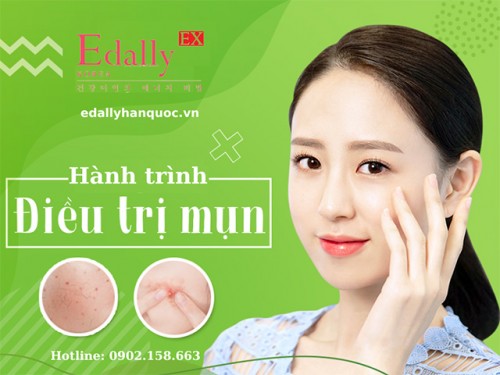 Hành Trình Trị Mụn