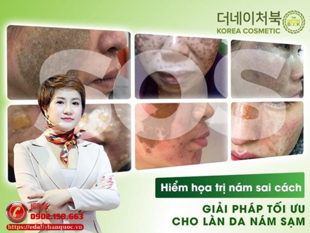 Hậu quả của việc điều trị nám da sai cách là gì?