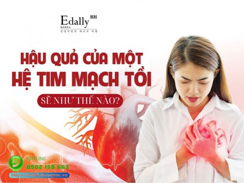 Bệnh Tim Mạch Và Những Điều Cần Biết