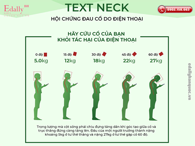 Hãy cứu lấy cổ của bạn khỏi tác hại do hội chứng Text Neck