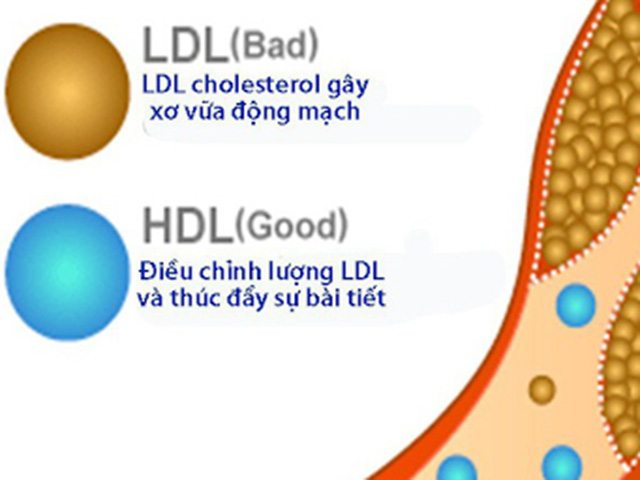 HDL - cholesterol giảm là dấu hiệu cảnh báo mỡ máu cao