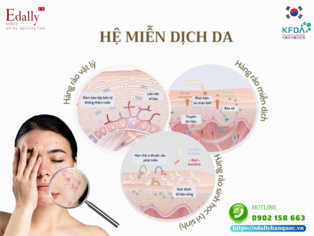 Hệ miễn dịch da (skinmunity) và vai trò của nó đôi với làn da