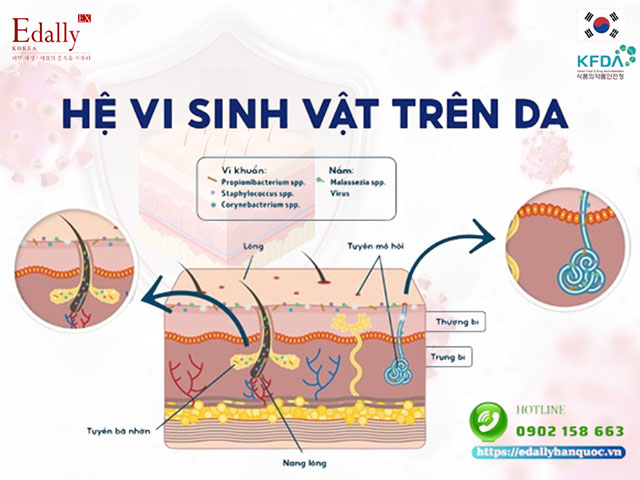 Hệ vi sinh vật trên da