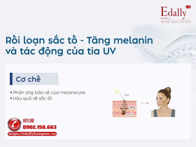 Sau hè làn da thường gặp phải vấn đề rối loạn sắc tố - Tăng melanin và tác động của tia UV