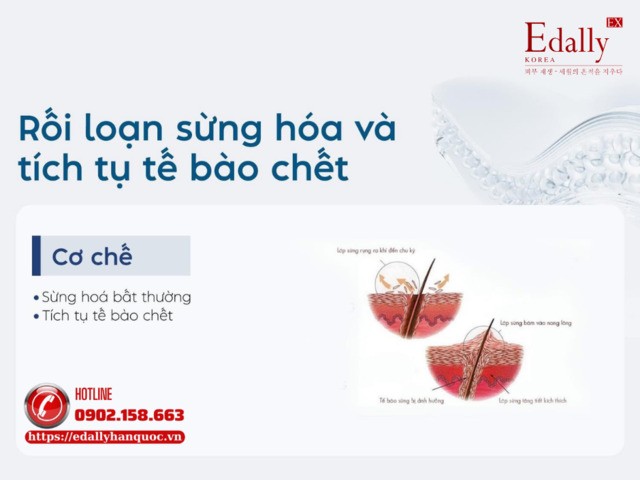 Sau hè làn da thường gặp phải vấn đề rối loạn sừng hóa và tích tụ tế bào chết
