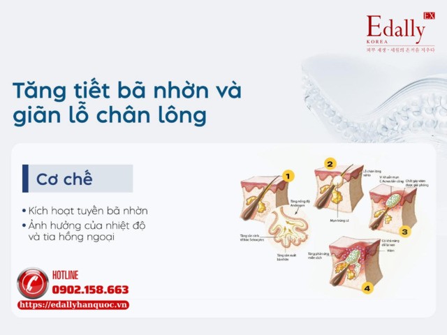 Sau hè làn da thường gặp phải vấn đề tăng tiết bã nhờn và giãn lỗ chân lông