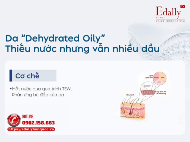Sau hè làn da thường gặp phải vấn đề “Dehydrated Oily” - Thiếu nước nhưng vẫn nhiều dầu