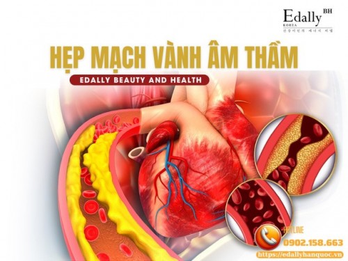 Hẹp Mạch Vành Âm Thầm: Nguy Cơ Nhồi Máu Cơ Tim Luôn Rình Rập