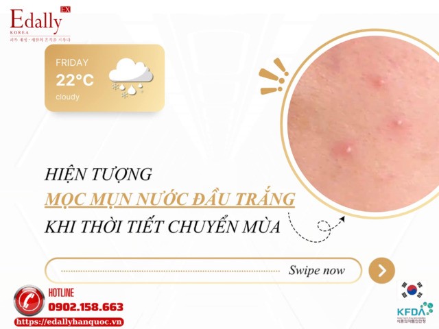 Hiện tượng mọc mụn nước đầu trắng khi thời tiết chuyển mùa và cách khắc phục, phòng ngừa hiệu quả