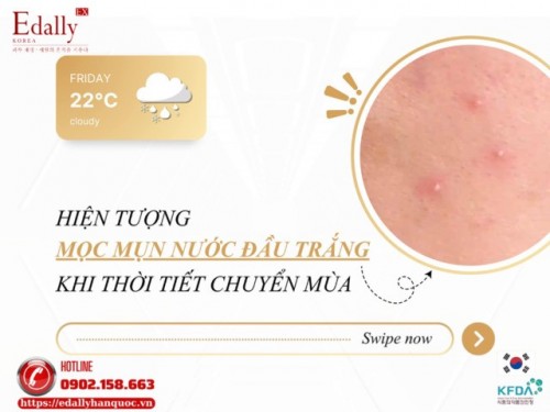 Hiện Tượng Mọc Mụn Nước Đầu Trắng Khi Thời Tiết Chuyển Mùa