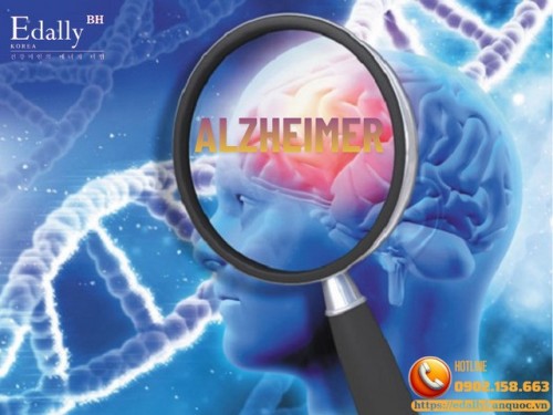 Hiểu Đúng Về Bệnh Alzheimer - Bệnh Lý Nội Thần Kinh Cần Kiểm Soát