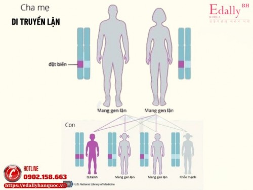 Hiểu Đúng Về Bệnh Thận Trước Khi Quyết Định Kết Hôn Hoặc Sinh Con - Đừng Vội Lo Di Truyền