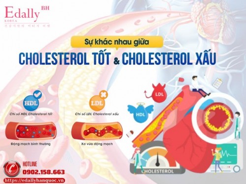 Hiểu Đúng Về Mỡ Máu Tốt Và Mỡ Máu Xấu Để Bảo Vệ Sức Khỏe Tim Mạch
