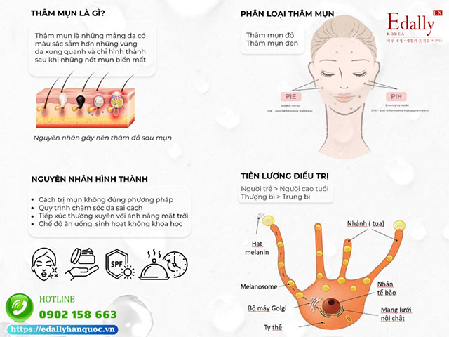 Hiểu đúng về thâm mụn