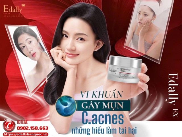 5 hiểu lầm về vi khuẩn gây mụn C.acnes dễ khiến càng trị càng dễ nặng