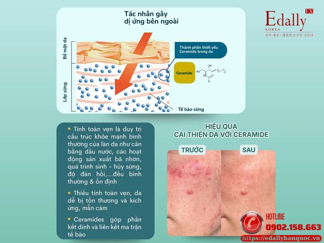 Hiệu quả của Ceramide đối với làn da