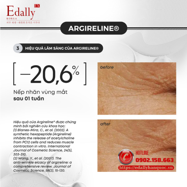 Hiệu quả lâm sàng của Argireline® (Acetyl Hexapeptide-8) đối với làn da