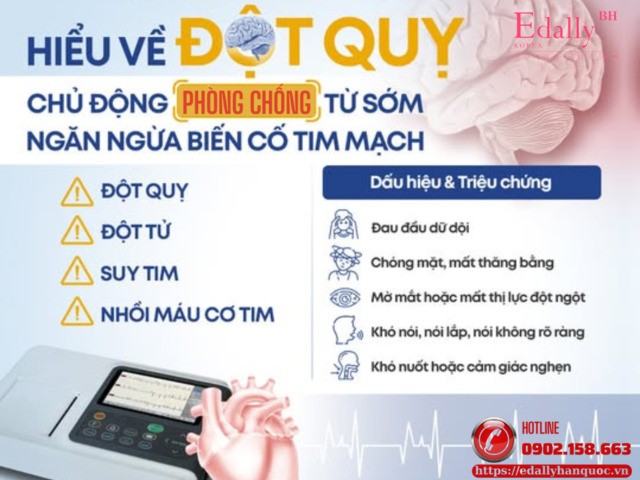 Hiểu về đột quỵ để chủ động phòng chống từ sớm, ngăn ngừa biến cố tim mạch