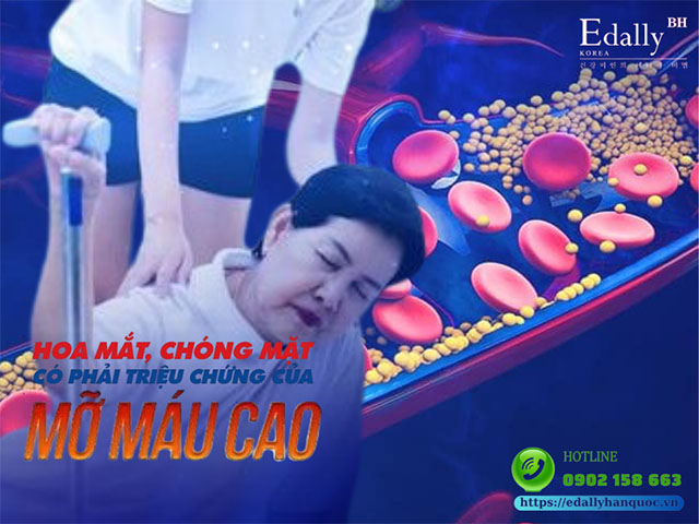 Hoa mắt, chóng mặt có phải là dấu hiệu của mỡ máu cao hay không?