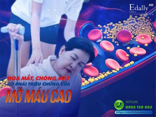 Hoa Mắt, Chóng Mặt Có Phải Là Biểu Hiện Của Mỡ Máu Cao Hay Không?