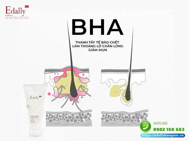 BHA là hoạt chất giúp cải thiện kích thước lỗ chân lông to hiệu quả