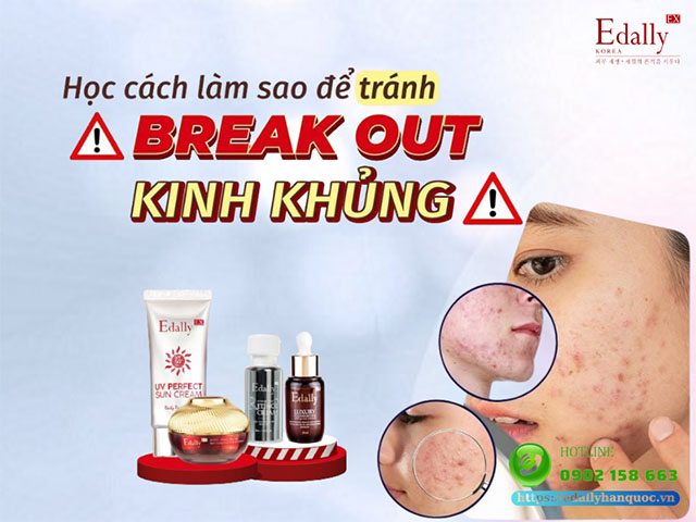 Học cách làm sao để tránh da bị Break out kinh khủng