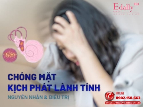 Hội Chứng Chóng Mặt Kịch Phát Tư Thế Lành Tính