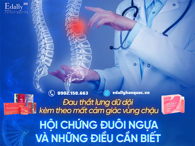 Hội chứng chùm đuôi ngựa (CES) và những điều cần biết để phòng ngừa biến chứng nguy hiểm