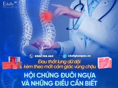 Hội Chứng Chùm Đuôi Ngựa (CES) Và Những Điều Cần Biết