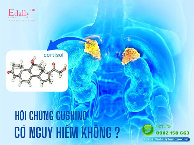 Bệnh Cushing có nguy hiểm không?