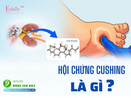 Hội Chứng Cushing Là Gì Và Có Nguy Hiểm Không?