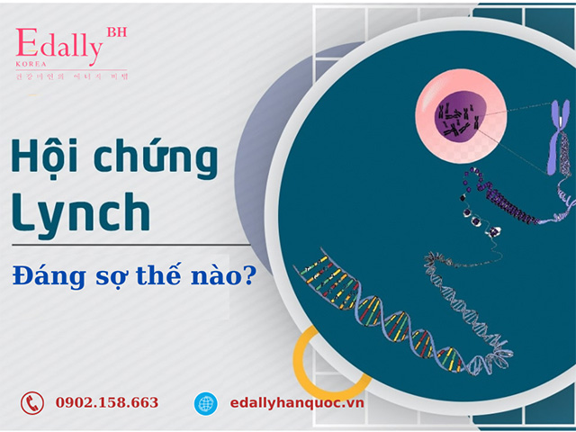 Hội chứng Lynch vô cùng đáng sợ vì nó mang yếu tố di truyền