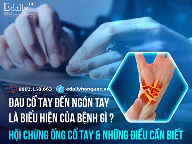 Hội chứng ống cổ tay và những điều cần biết