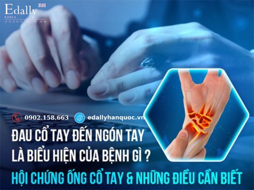 Hội Chứng Ống Cổ Tay Và Những Điều Cần Biết