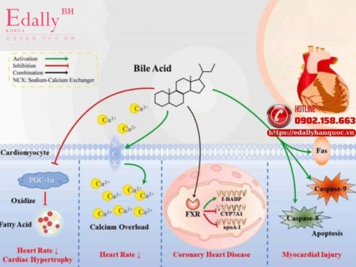 Hội Chứng Tim - Mật (Cholecardia Syndrome): Nguy Cơ Và Cách Điều Trị