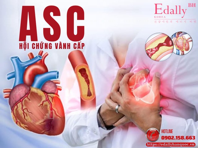 Điều trị cấp cứu Hội chứng vành cấp (ASC): từ hồi sức ban đầu đến tái tưới máu mạch vành
