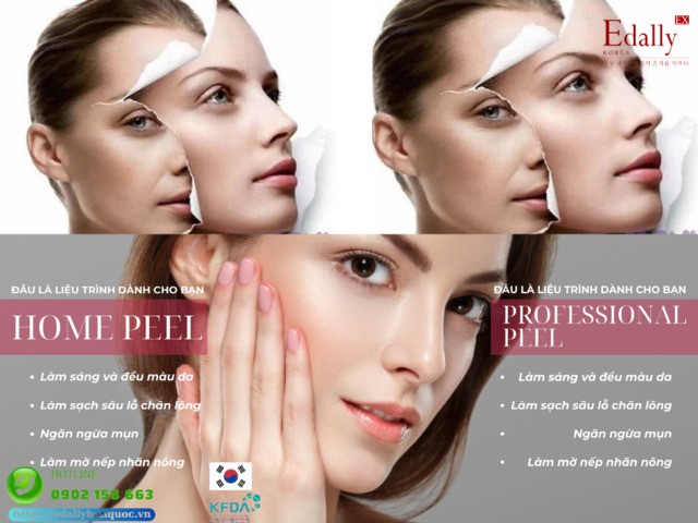 Homepeel hay Professional peel đâu là liệu trình dành cho bạn?