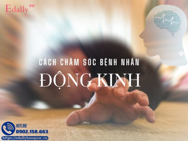 Hướng dẫn cách chăm sóc bệnh nhân động kinh