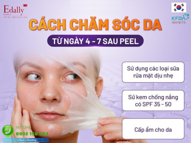 Cách chăm sóc da từ ngày 4 - 7 sau peel tại nhà, an toàn, hiệu quả