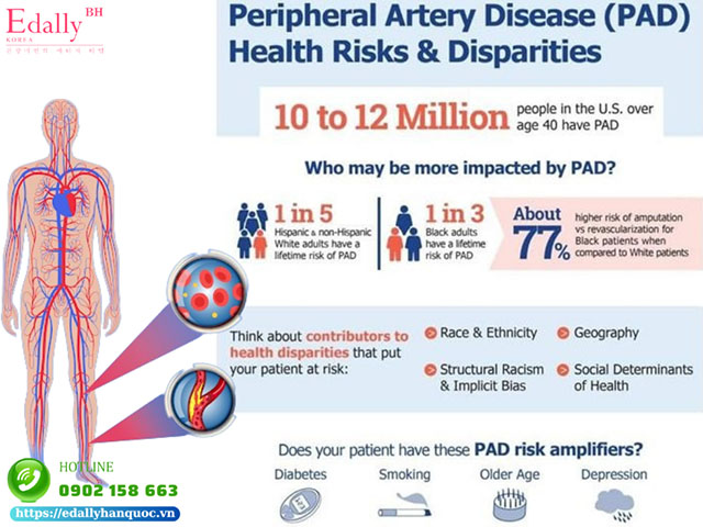 Hướng dẫn điều trị bệnh động mạch chi dưới (PAD) của Hội Tim mạch Hoa Kỳ và Trường môn Tim mạch Hoa Kỳ (ACC/AHA) cùng 9 Hiệp hội khác