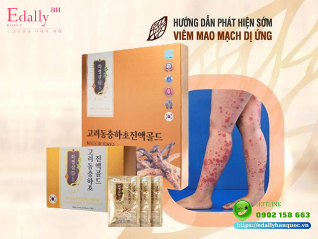 Viêm mao mạch dị ứng làm sao để nhận biết sớm?