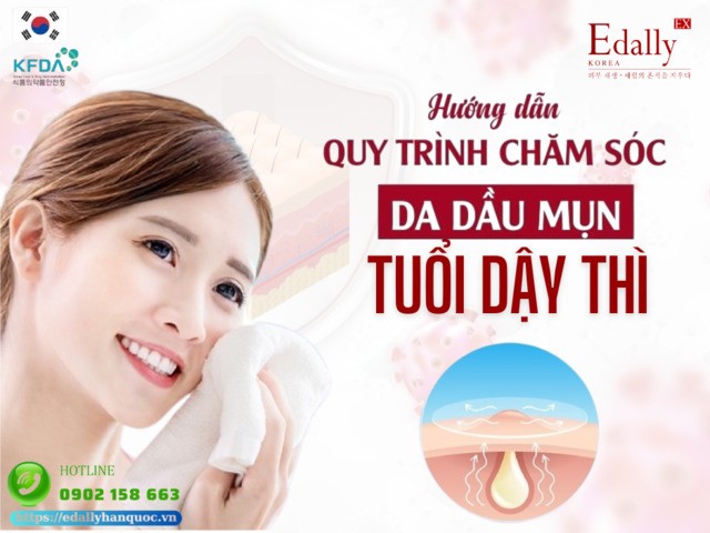 Hướng dẫn cách chăm sóc da dầu, mụn tuổi dậy thì tại nhà hiệu quả