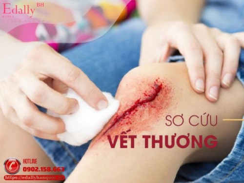 Hướng Dẫn Xử Trí Vết Thương Tại Nhà Và Khi Nào Cần Hỗ Trợ Y Tế