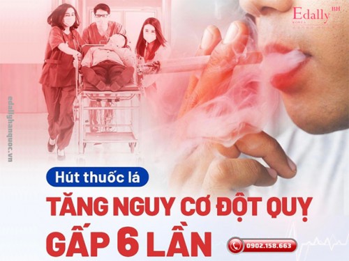 Hút Thuốc Lá Làm Tăng Nguy Cơ Đột Quỵ Gấp 6 Lần