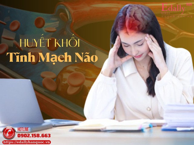 Huyết Khối Tĩnh Mạch Não (CVT)