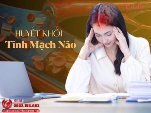 Huyết Khối Tĩnh Mạch Não (CVT)