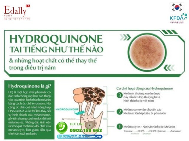 Hydroquinone tai tiếng như thế nào trong điều trị tăng sắc tố da?