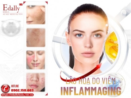 Inflammaging - Lý Do Skincare Hoài Mà Da Vẫn Không Sáng, Không Mịn