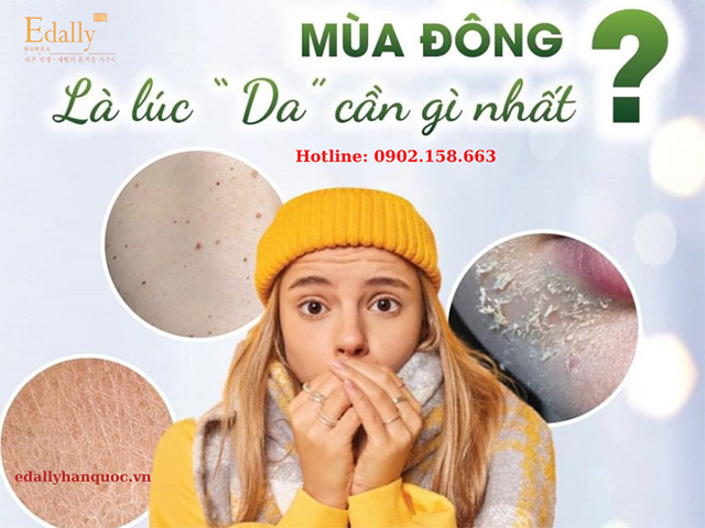 Làn da cần gì vào mùa đông lạnh, hanh khô?